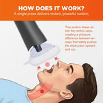 VacSave Anti Choking Rescue Device